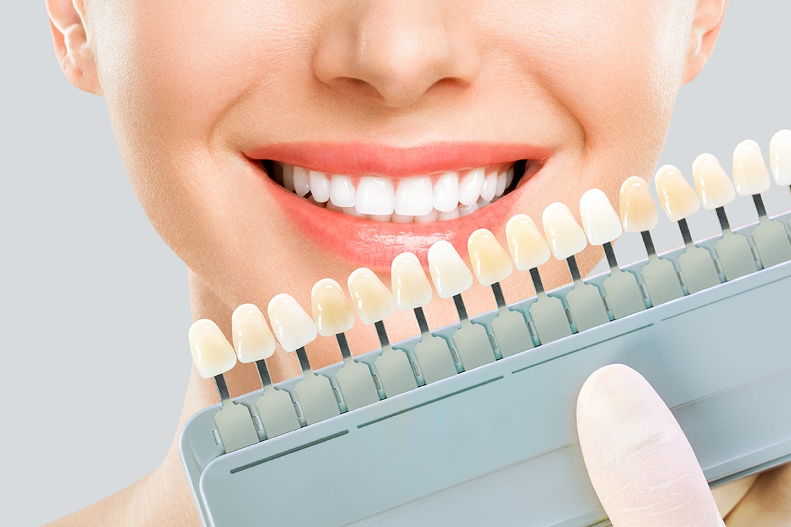 Cosmetic Dentistry teeth whitening dentist near me in Brisbane