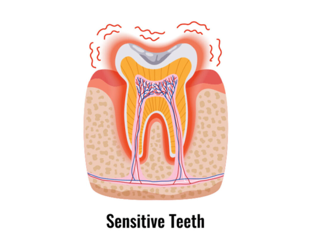 dentists can desensitize a tooth